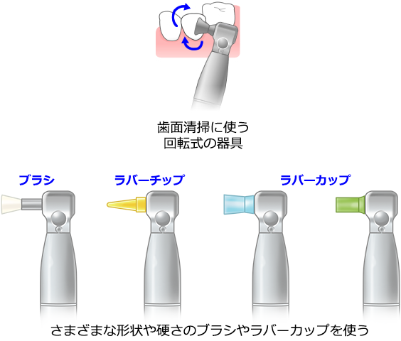 ラバーチップによる歯面清掃